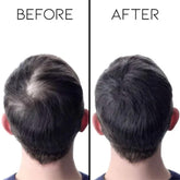 Biotin cold pressed original anti hair loss oil 30ml - Hopshop